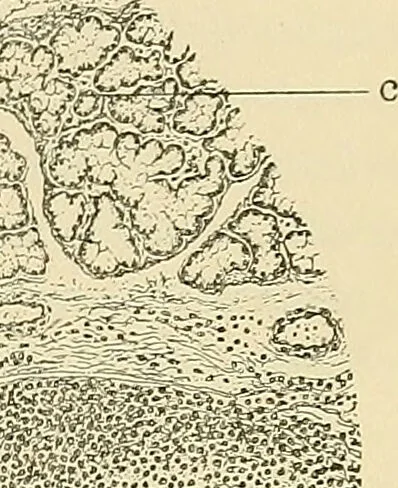 An illustration from Diseases of the nose and throat / by J. Price-Brown ; ill. with 159 engravings, including 6 full-page color-plates and 9 color-cuts in the text, many of them original., 1900, leaf 287
