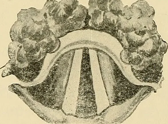 An illustration from Diseases of the nose and throat / by J. Price-Brown ; ill. with 159 engravings, including 6 full-page color-plates and 9 color-cuts in the text, many of them original., 1900, leaf 308