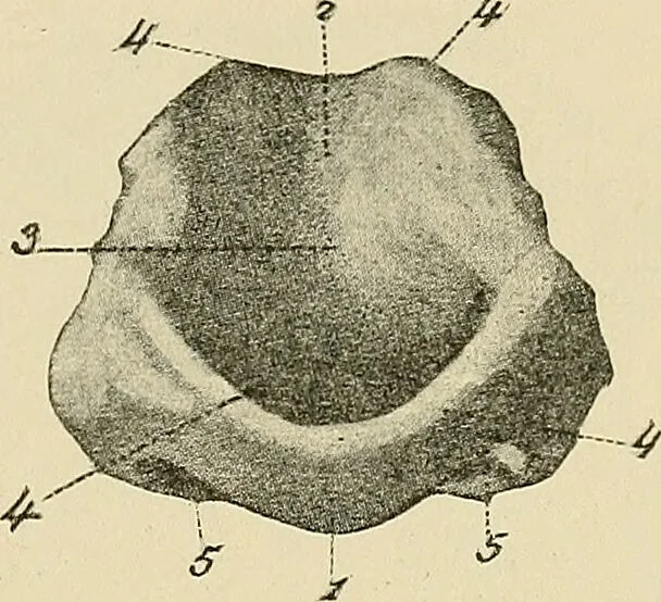 An illustration from Diseases of the nose and throat / by J. Price-Brown ; ill. with 159 engravings, including 6 full-page color-plates and 9 color-cuts in the text, many of them original., 1900, leaf 353