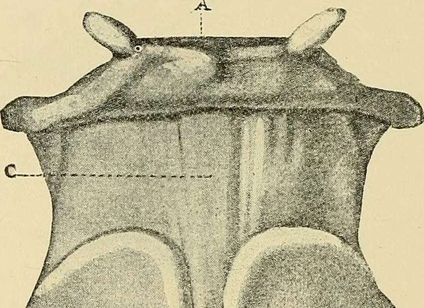 An illustration from Diseases of the nose and throat / by J. Price-Brown ; ill. with 159 engravings, including 6 full-page color-plates and 9 color-cuts in the text, many of them original., 1900, leaf 354