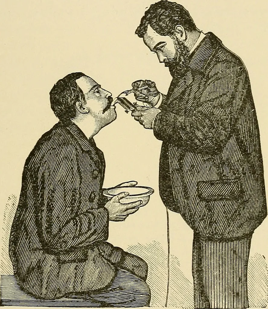 An illustration from Diseases of the nose and throat / by J. Price-Brown ; ill. with 159 engravings, including 6 full-page color-plates and 9 color-cuts in the text, many of them original., 1900, leaf 371
