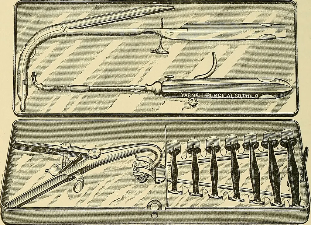 An illustration from Diseases of the nose and throat / by J. Price-Brown ; ill. with 159 engravings, including 6 full-page color-plates and 9 color-cuts in the text, many of them original., 1900, leaf 374