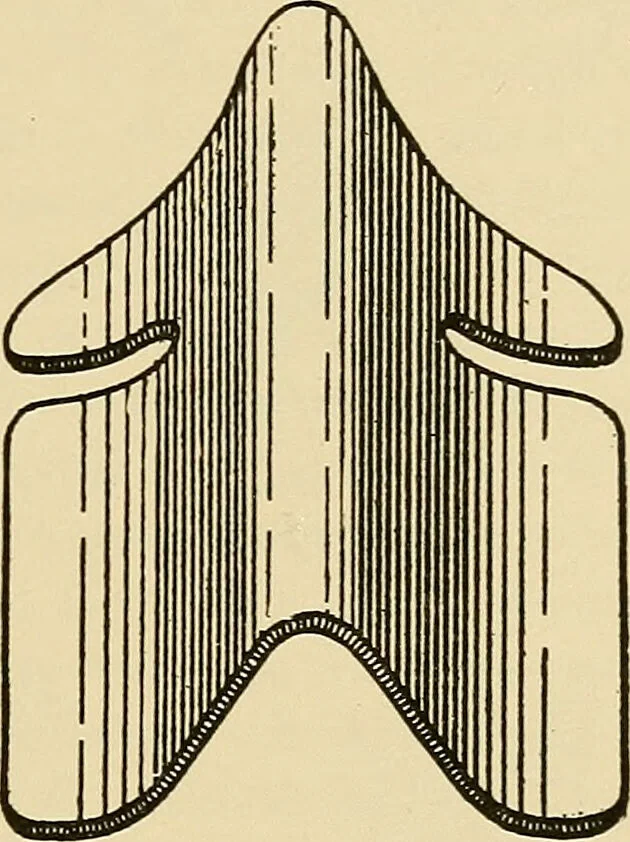 An illustration from Diseases of the nose and throat / by J. Price-Brown ; ill. with 159 engravings, including 6 full-page color-plates and 9 color-cuts in the text, many of them original., 1900, leaf 473