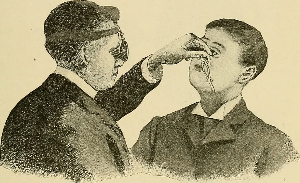 An illustration from Diseases of the nose and throat / by J. Price-Brown ; ill. with 159 engravings, including 6 full-page color-plates and 9 color-cuts in the text, many of them original., 1900, leaf 53