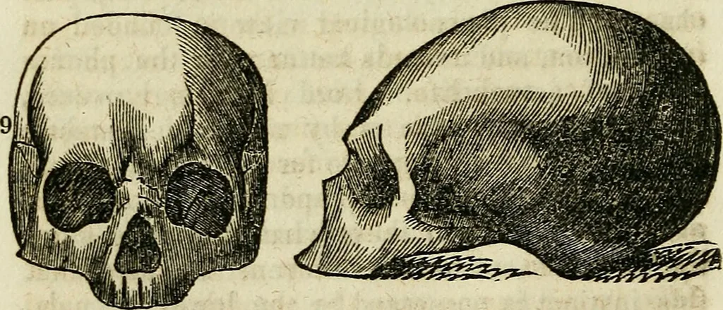 An illustration from Elements of phrenology / By George Combe. From the fifth Edinburgh improved and enlarged edition. With illustrations., 1846, leaf 108