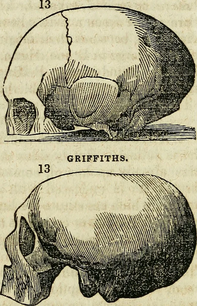 An illustration from Elements of phrenology / By George Combe. From the fifth Edinburgh improved and enlarged edition. With illustrations., 1846, leaf 120