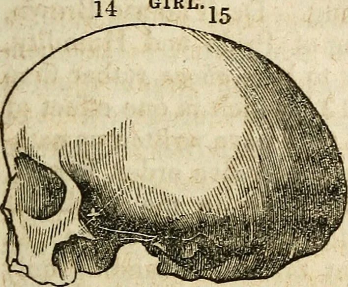 An illustration from Elements of phrenology / By George Combe. From the fifth Edinburgh improved and enlarged edition. With illustrations., 1846, leaf 123