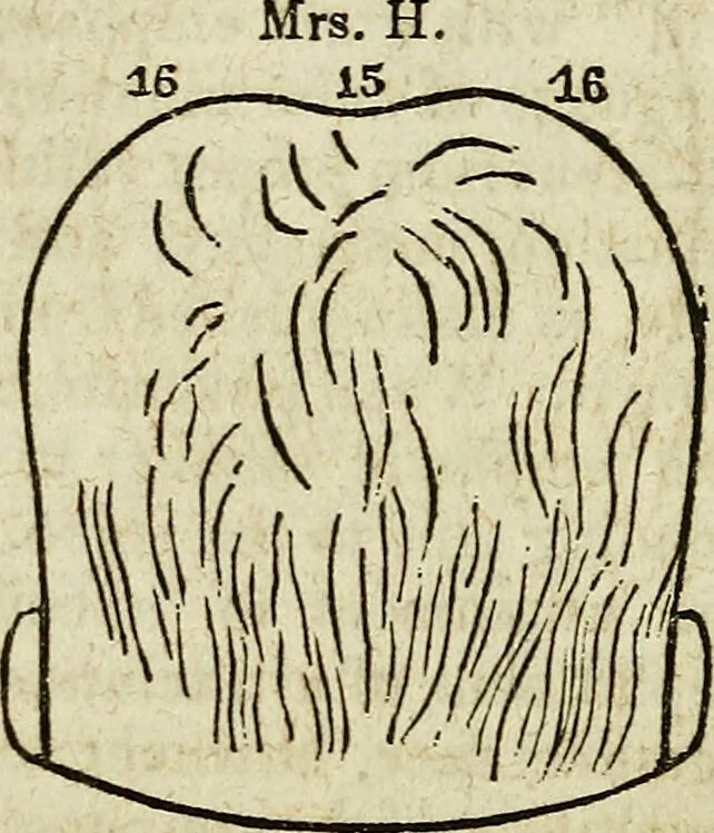 An illustration from Elements of phrenology / By George Combe. From the fifth Edinburgh improved and enlarged edition. With illustrations., 1846, leaf 126