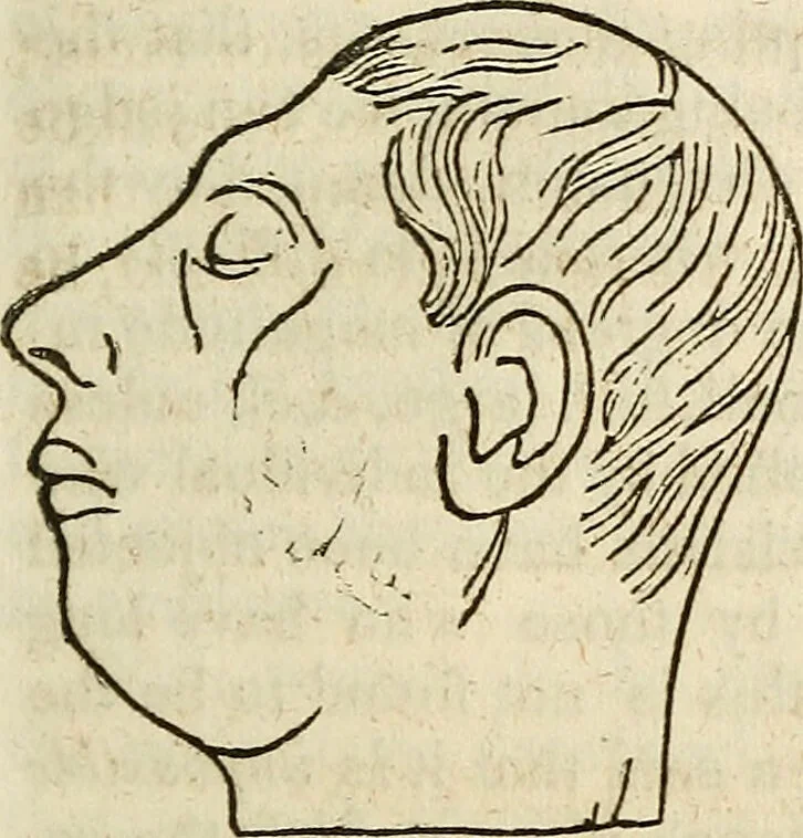 An illustration from Elements of phrenology / By George Combe. From the fifth Edinburgh improved and enlarged edition. With illustrations., 1846, leaf 199