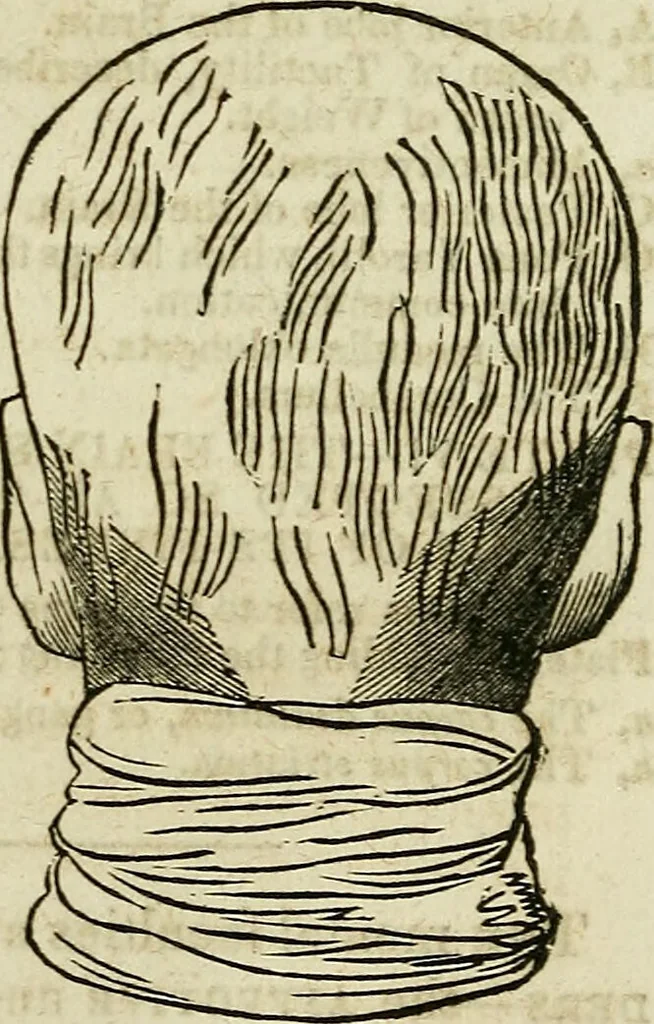 An illustration from Elements of phrenology / By George Combe. From the fifth Edinburgh improved and enlarged edition. With illustrations., 1846, leaf 86
