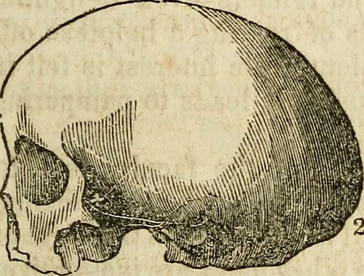 An illustration from Elements of phrenology / By George Combe. From the fifth Edinburgh improved and enlarged edition. With illustrations., 1846, leaf 89