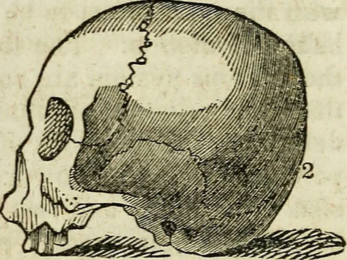 An illustration from Elements of phrenology / By George Combe. From the fifth Edinburgh improved and enlarged edition. With illustrations., 1846, leaf 90