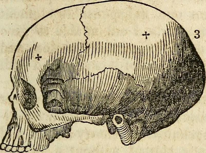An illustration from Elements of phrenology / By George Combe. From the fifth Edinburgh improved and enlarged edition. With illustrations., 1846, leaf 91