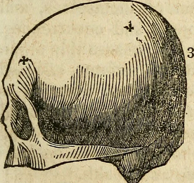 An illustration from Elements of phrenology / By George Combe. From the fifth Edinburgh improved and enlarged edition. With illustrations., 1846, leaf 91