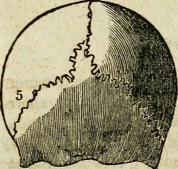 An illustration from Elements of phrenology / By George Combe. From the fifth Edinburgh improved and enlarged edition. With illustrations., 1846, leaf 96