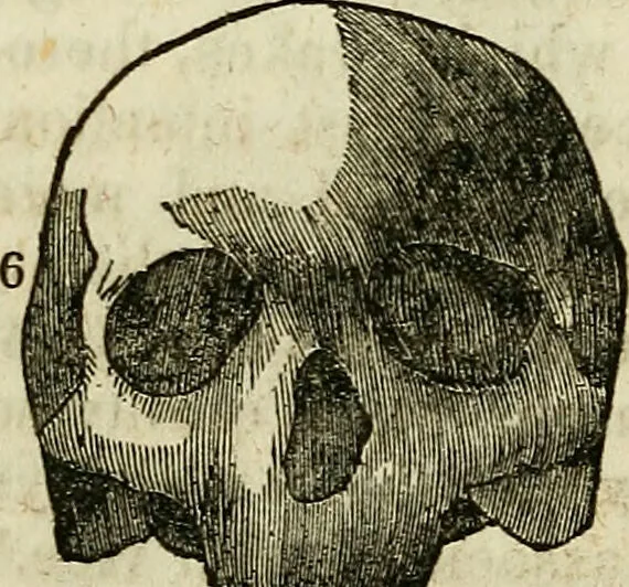 An illustration from Elements of phrenology / By George Combe. From the fifth Edinburgh improved and enlarged edition. With illustrations., 1846, leaf 98
