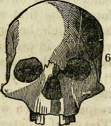 An illustration from Elements of phrenology / By George Combe. From the fifth Edinburgh improved and enlarged edition. With illustrations., 1846, leaf 98