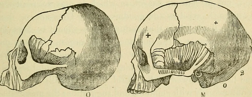 An illustration from Lectures on phrenology / By George Combe, Esq. With notes, an introductory essay, and a historical sketch by Andrew Boardman, M.D., 1895, leaf 143