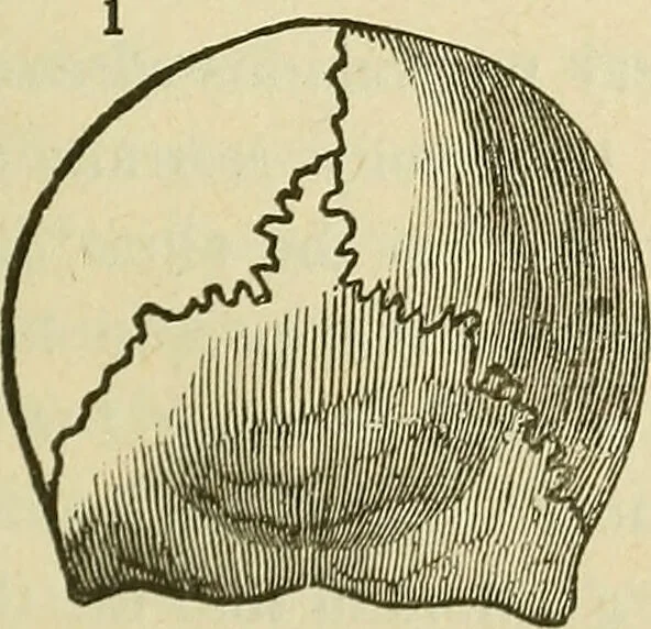 An illustration from Lectures on phrenology / By George Combe, Esq. With notes, an introductory essay, and a historical sketch by Andrew Boardman, M.D., 1895, leaf 155