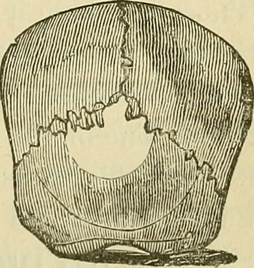 An illustration from Lectures on phrenology / By George Combe, Esq. With notes, an introductory essay, and a historical sketch by Andrew Boardman, M.D., 1895, leaf 155