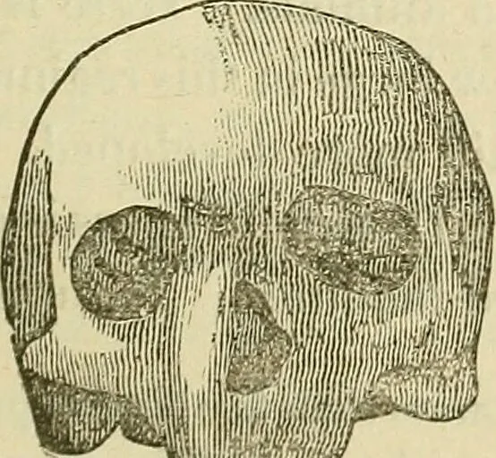 An illustration from Lectures on phrenology / By George Combe, Esq. With notes, an introductory essay, and a historical sketch by Andrew Boardman, M.D., 1895, leaf 161