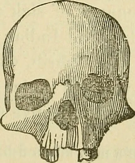 An illustration from Lectures on phrenology / By George Combe, Esq. With notes, an introductory essay, and a historical sketch by Andrew Boardman, M.D., 1895, leaf 161