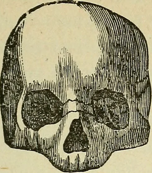 An illustration from Lectures on phrenology / By George Combe, Esq. With notes, an introductory essay, and a historical sketch by Andrew Boardman, M.D., 1895, leaf 179