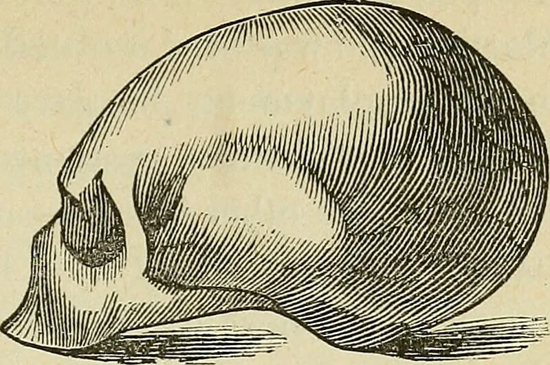 An illustration from Lectures on phrenology / By George Combe, Esq. With notes, an introductory essay, and a historical sketch by Andrew Boardman, M.D., 1895, leaf 179