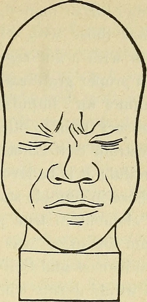 An illustration from Lectures on phrenology / By George Combe, Esq. With notes, an introductory essay, and a historical sketch by Andrew Boardman, M.D., 1895, leaf 197