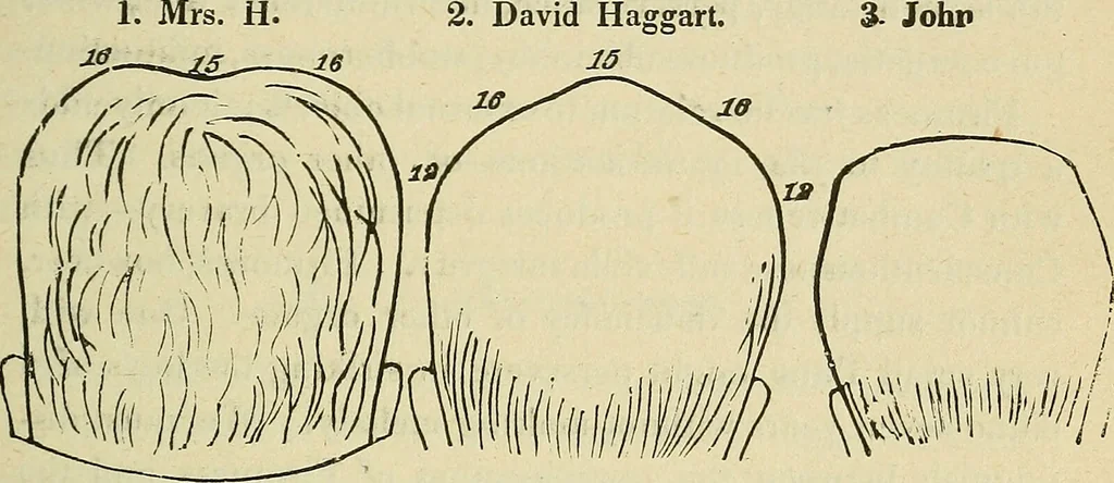 An illustration from Lectures on phrenology / By George Combe, Esq. With notes, an introductory essay, and a historical sketch by Andrew Boardman, M.D., 1895, leaf 207