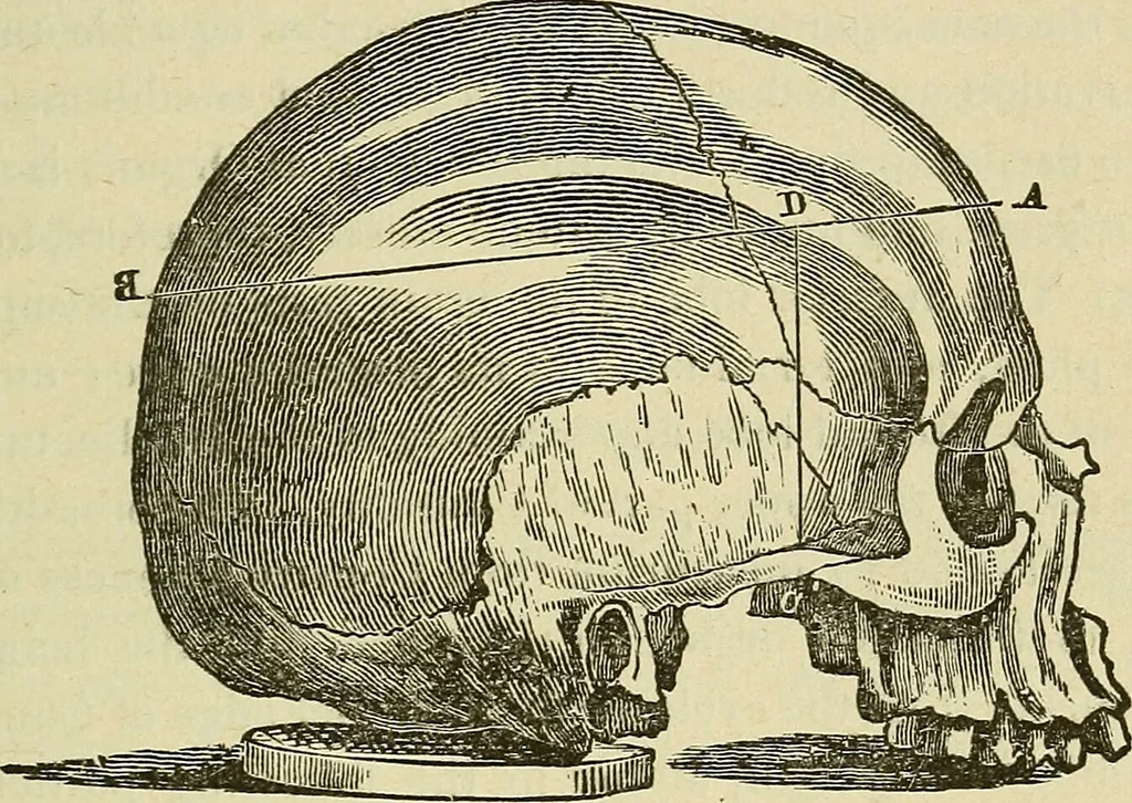 An illustration from Lectures on phrenology / By George Combe, Esq. With notes, an introductory essay, and a historical sketch by Andrew Boardman, M.D., 1895, leaf 233