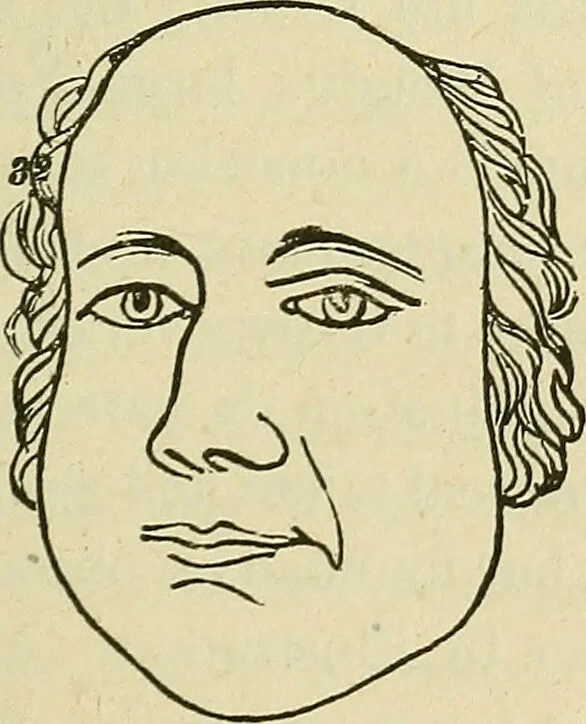 An illustration from Lectures on phrenology / By George Combe, Esq. With notes, an introductory essay, and a historical sketch by Andrew Boardman, M.D., 1895, leaf 261