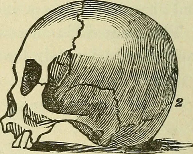An illustration from Lectures on phrenology / By George Combe, Esq. With notes, an introductory essay, and a historical sketch by Andrew Boardman, M.D., 1895, leaf 38