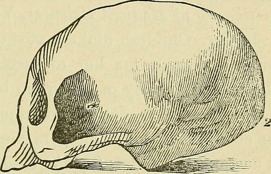 An illustration from Lectures on phrenology / By George Combe, Esq. With notes, an introductory essay, and a historical sketch by Andrew Boardman, M.D., 1895, leaf 45