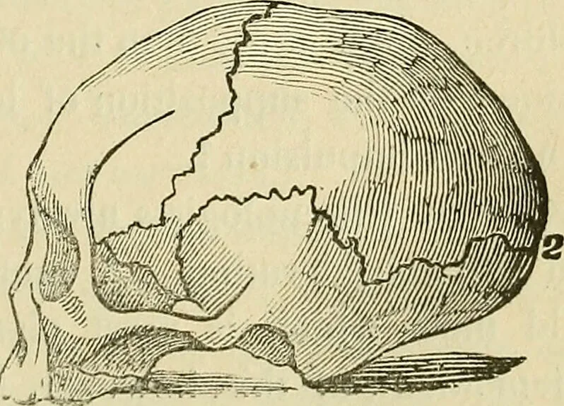 An illustration from Lectures on phrenology / By George Combe, Esq. With notes, an introductory essay, and a historical sketch by Andrew Boardman, M.D., 1895, leaf 45