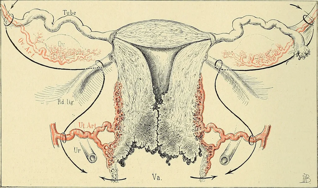 An illustration from Cancer of the uterus : its pathology, symptomatology, diagnosis, and treatment : also the pathology of diseases of the endometrium / by Thomas Stephen Cullen ; with eleven lithographic plates and over three hundred coloured and black illustrations in the text by May Brödel and Hermann Becker., 1900, leaf 272