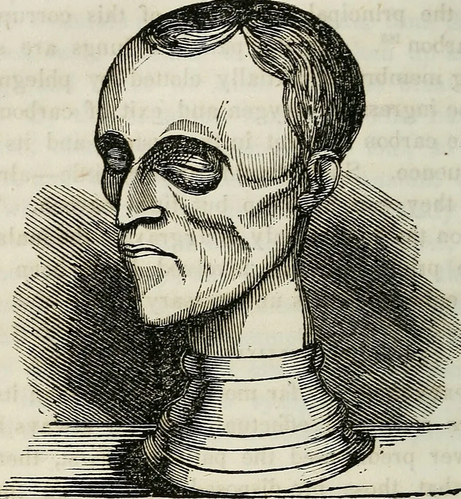 An illustration from Physiology, animal and mental: applied to the preservation and restoration of health of body and power of mind / by O.S. Fowler., 1847, leaf 304