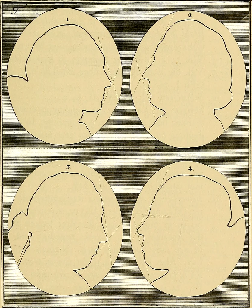 An illustration from Goethes Anteil an Lavaters Physiognomischen Fragmenten / von Eduard von der Hellen., 1888, leaf 151