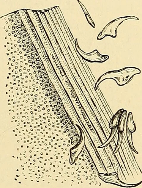 An illustration from Clinical diagnosis : the bacteriological, chemical, and microscopical evidence of disease / by Rudolf v. Jaksch ; tr. from the 3rd German ed. and enlarged by James Cagney ; with numerous illustrations (partly in colours)., 1893, leaf 137