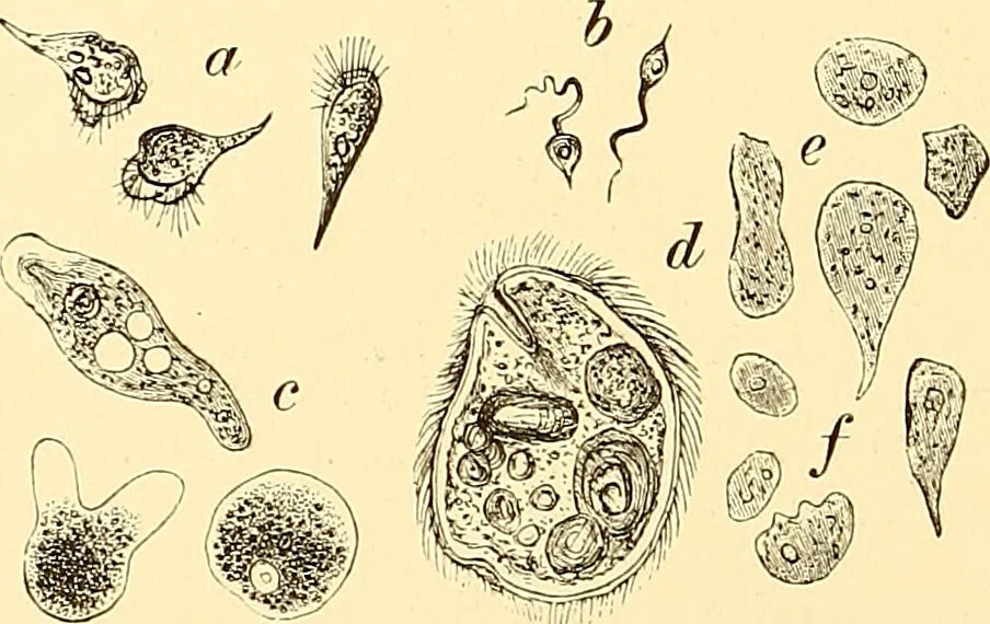 An illustration from Clinical diagnosis : the bacteriological, chemical, and microscopical evidence of disease / by Rudolf v. Jaksch ; tr. from the 3rd German ed. and enlarged by James Cagney ; with numerous illustrations (partly in colours)., 1893, leaf 208