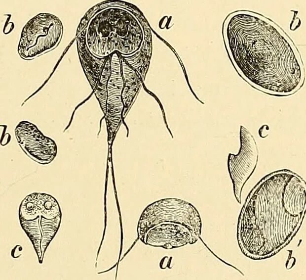 An illustration from Clinical diagnosis : the bacteriological, chemical, and microscopical evidence of disease / by Rudolf v. Jaksch ; tr. from the 3rd German ed. and enlarged by James Cagney ; with numerous illustrations (partly in colours)., 1893, leaf 209