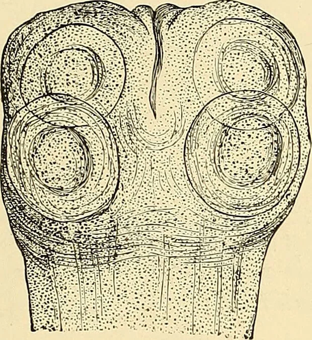 An illustration from Clinical diagnosis : the bacteriological, chemical, and microscopical evidence of disease / by Rudolf v. Jaksch ; tr. from the 3rd German ed. and enlarged by James Cagney ; with numerous illustrations (partly in colours)., 1893, leaf 211