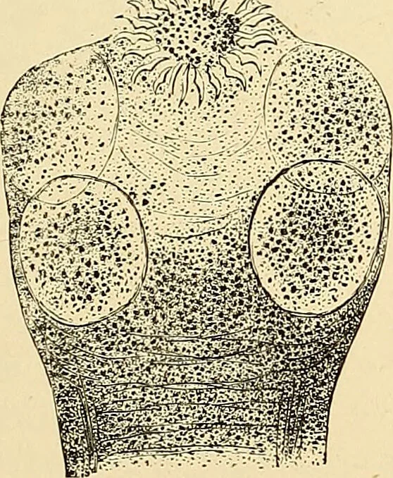 An illustration from Clinical diagnosis : the bacteriological, chemical, and microscopical evidence of disease / by Rudolf v. Jaksch ; tr. from the 3rd German ed. and enlarged by James Cagney ; with numerous illustrations (partly in colours)., 1893, leaf 211