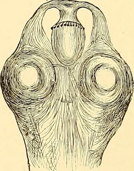 An illustration from Clinical diagnosis : the bacteriological, chemical, and microscopical evidence of disease / by Rudolf v. Jaksch ; tr. from the 3rd German ed. and enlarged by James Cagney ; with numerous illustrations (partly in colours)., 1893, leaf 212