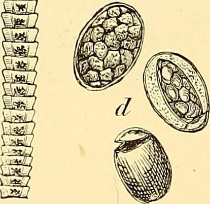 An illustration from Clinical diagnosis : the bacteriological, chemical, and microscopical evidence of disease / by Rudolf v. Jaksch ; tr. from the 3rd German ed. and enlarged by James Cagney ; with numerous illustrations (partly in colours)., 1893, leaf 214