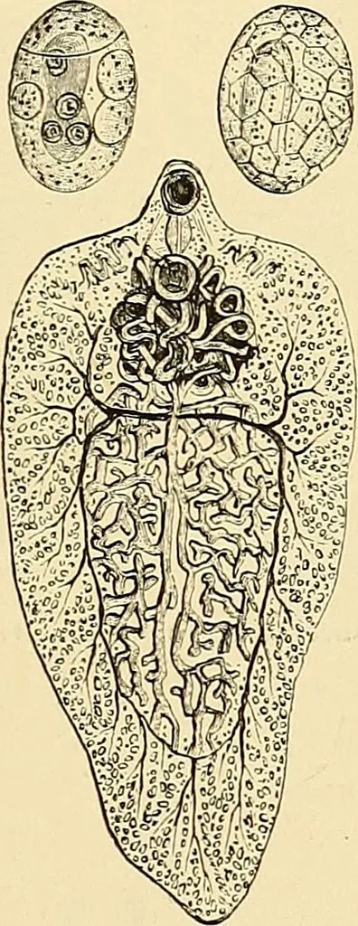 An illustration from Clinical diagnosis : the bacteriological, chemical, and microscopical evidence of disease / by Rudolf v. Jaksch ; tr. from the 3rd German ed. and enlarged by James Cagney ; with numerous illustrations (partly in colours)., 1893, leaf 215