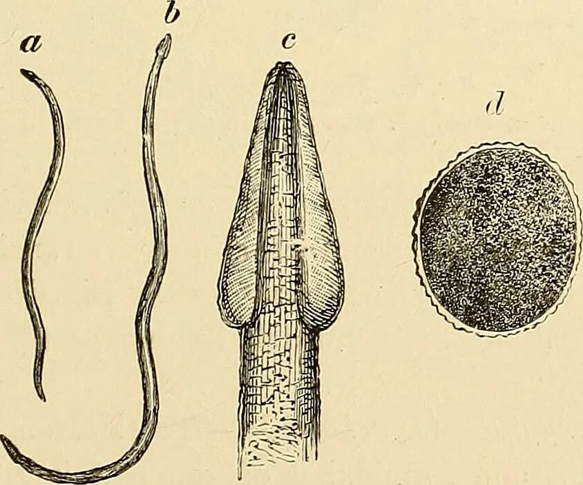 An illustration from Clinical diagnosis : the bacteriological, chemical, and microscopical evidence of disease / by Rudolf v. Jaksch ; tr. from the 3rd German ed. and enlarged by James Cagney ; with numerous illustrations (partly in colours)., 1893, leaf 217