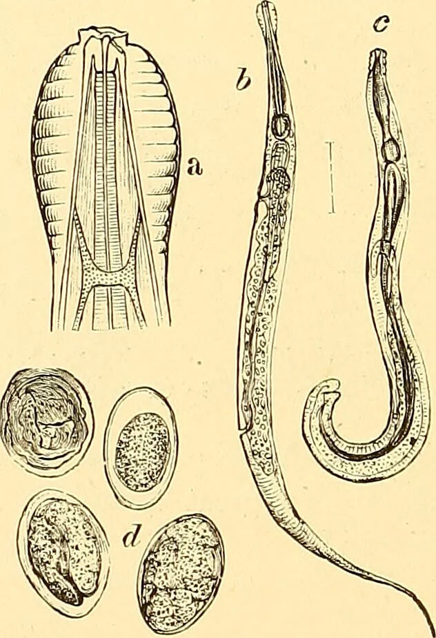 An illustration from Clinical diagnosis : the bacteriological, chemical, and microscopical evidence of disease / by Rudolf v. Jaksch ; tr. from the 3rd German ed. and enlarged by James Cagney ; with numerous illustrations (partly in colours)., 1893, leaf 218