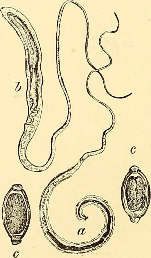 An illustration from Clinical diagnosis : the bacteriological, chemical, and microscopical evidence of disease / by Rudolf v. Jaksch ; tr. from the 3rd German ed. and enlarged by James Cagney ; with numerous illustrations (partly in colours)., 1893, leaf 220