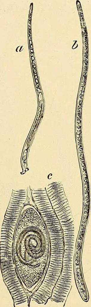 An illustration from Clinical diagnosis : the bacteriological, chemical, and microscopical evidence of disease / by Rudolf v. Jaksch ; tr. from the 3rd German ed. and enlarged by James Cagney ; with numerous illustrations (partly in colours)., 1893, leaf 221